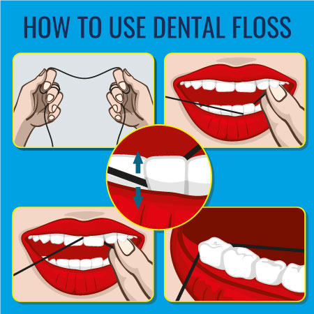 Dental Flossing Technique