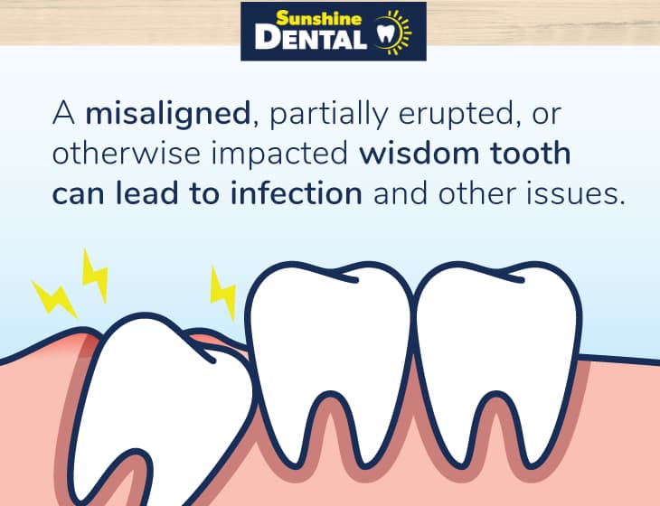 Why Is Wisdom Tooth Removal Necessary Sunridge Mall Calgary Ab