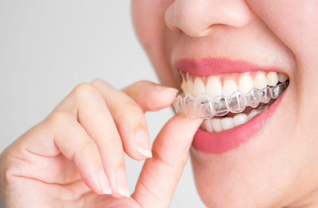 a woman smiles while placing invisalign trays on her top teeth