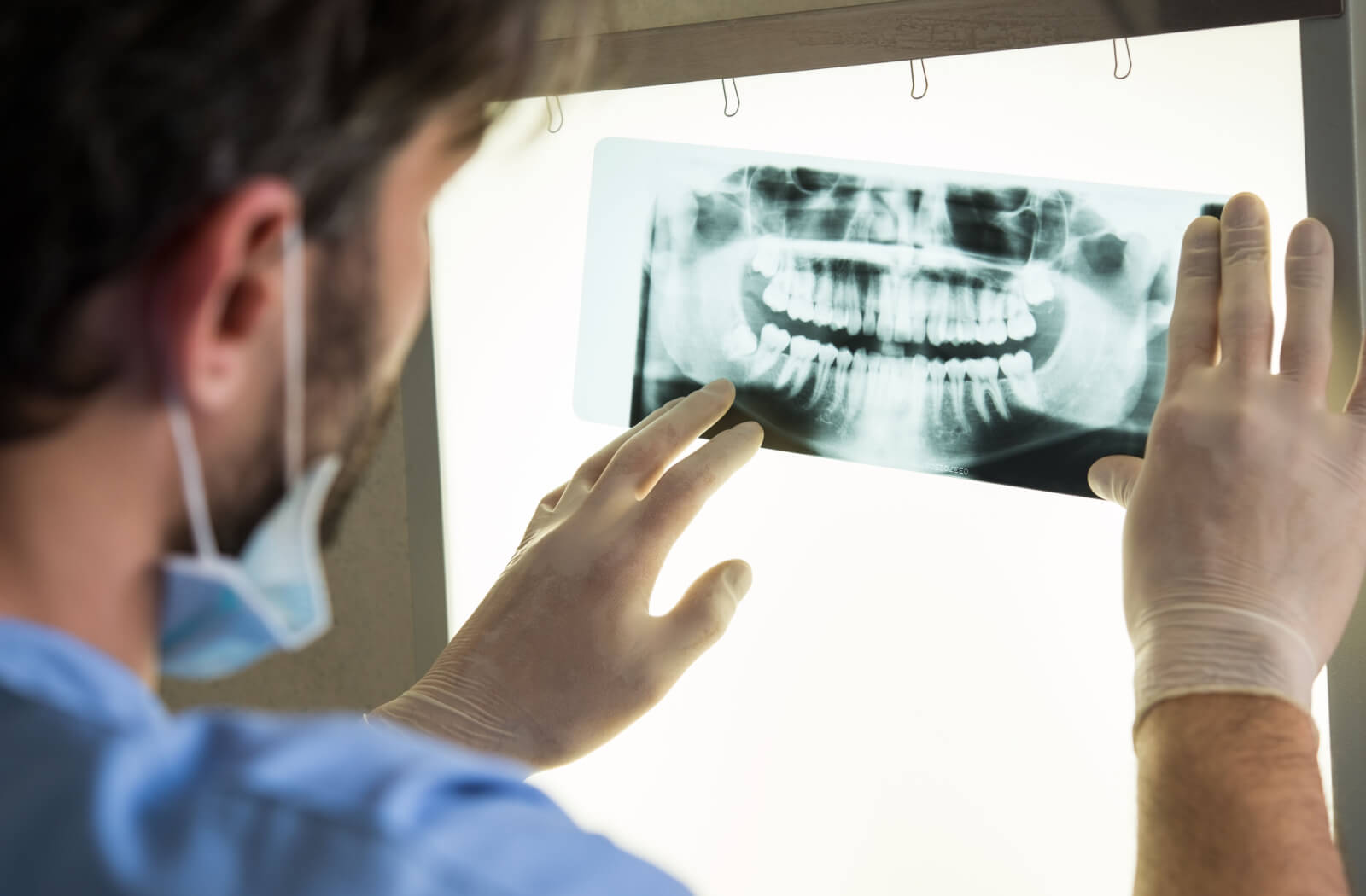 Close-up image of a male dentist examining a dental X-ray film.