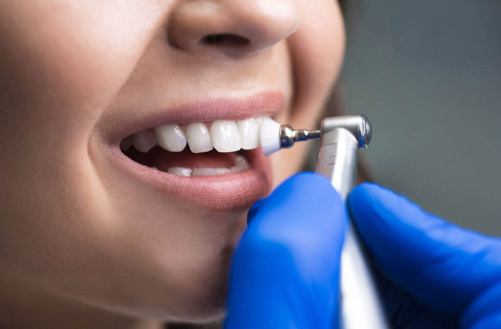 A patient undergoes a teeth cleaning, with the dentist diligently brushing her teeth to take care of her oral health