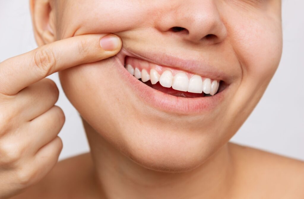 Up close image of sliming woman pulling back her mouth to show top right molars.